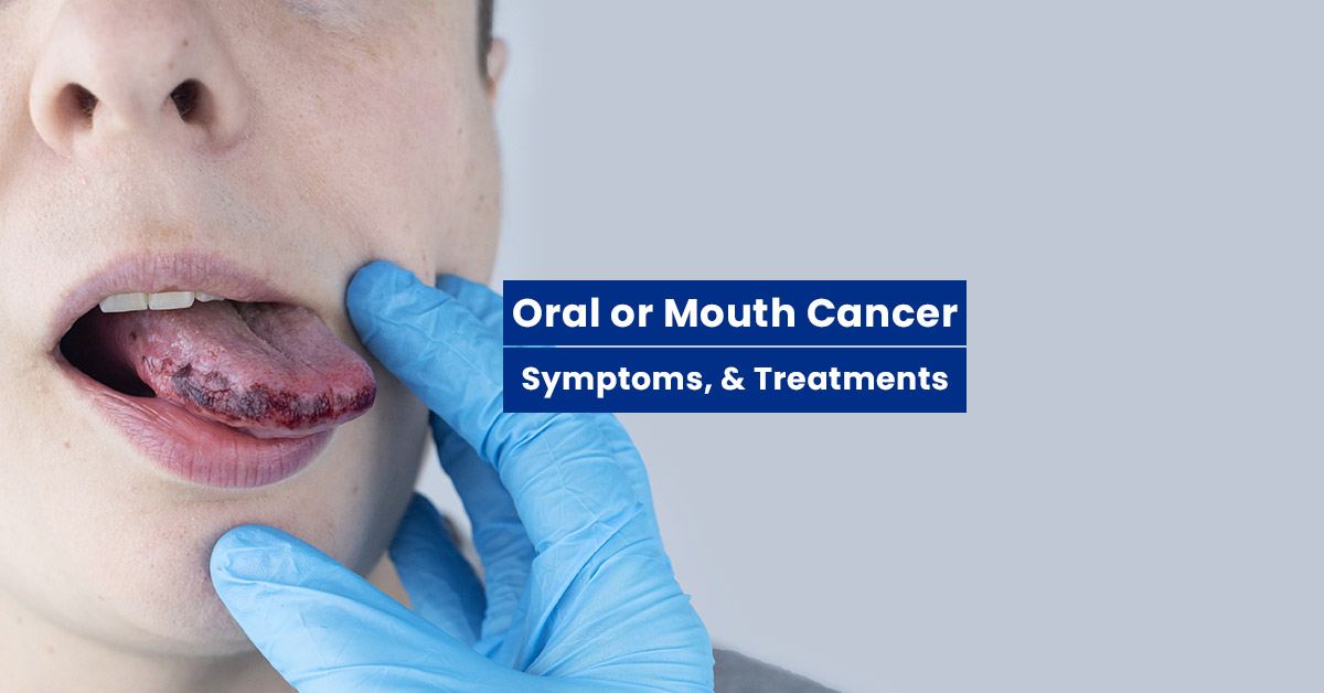 Understanding Oral, Mouth or Tongue Cancer: signs, Treatments
